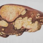 fungsi liver