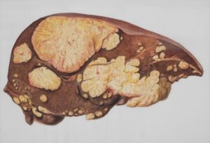 fungsi liver