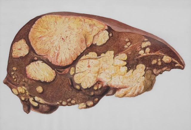 fungsi liver
